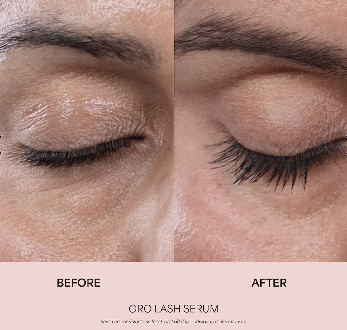 One eye before and after sixty days, a denser lash line after
